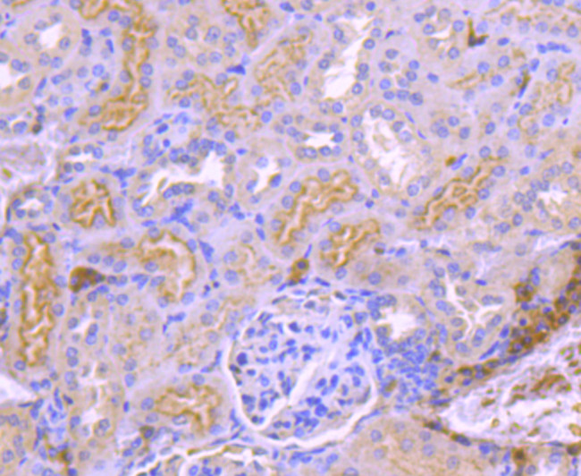 TrkA Antibody in Immunohistochemistry (Paraffin) (IHC (P))