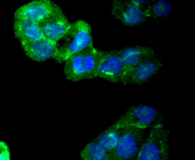 CaMKII Pan Antibody in Immunocytochemistry (ICC/IF)