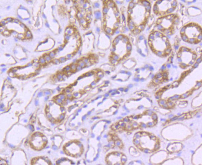 CD31 (PECAM-1) Antibody in Immunohistochemistry (Paraffin) (IHC (P))