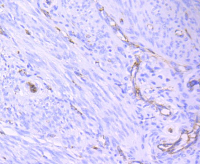 CD31 (PECAM-1) Antibody in Immunohistochemistry (Paraffin) (IHC (P))