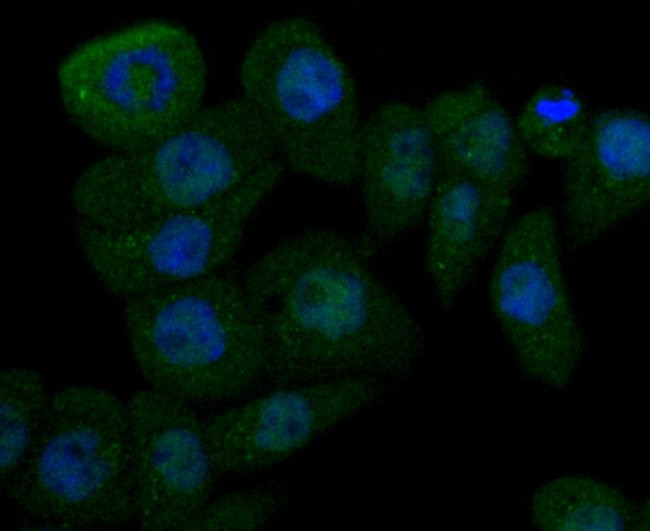 Cathepsin D Antibody in Immunocytochemistry (ICC/IF)