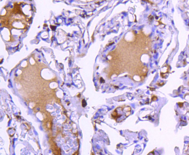 Cathepsin D Antibody in Immunohistochemistry (Paraffin) (IHC (P))