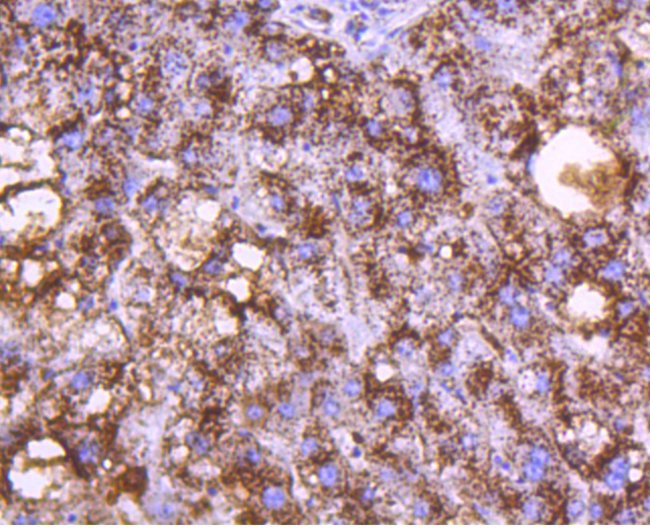 Cathepsin D Antibody in Immunohistochemistry (Paraffin) (IHC (P))