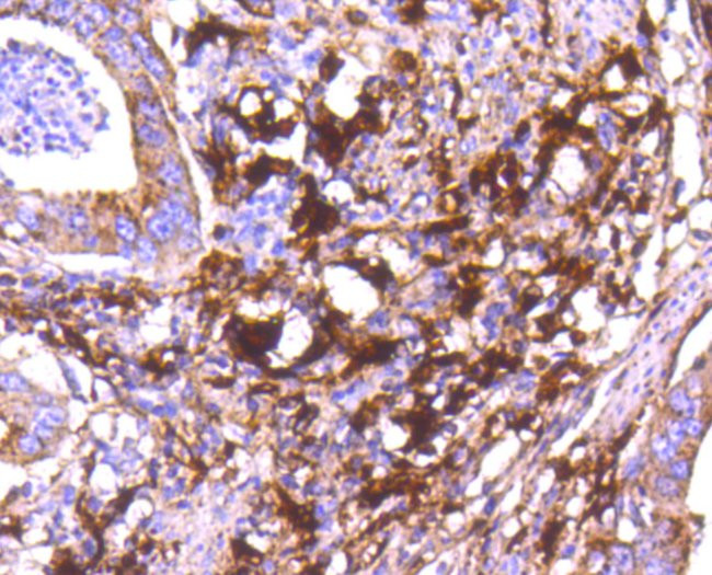 Cathepsin D Antibody in Immunohistochemistry (Paraffin) (IHC (P))