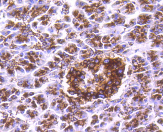 Cathepsin D Antibody in Immunohistochemistry (Paraffin) (IHC (P))