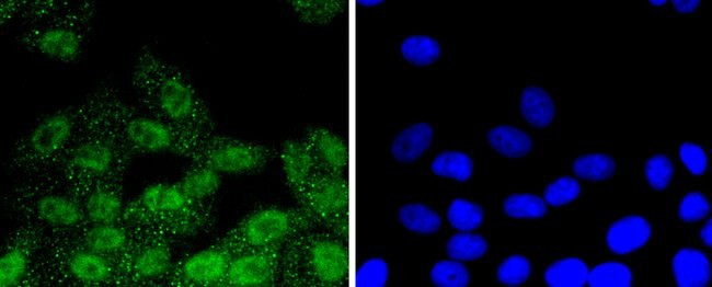 Phospho-RSK1 (Thr359, Ser363) Antibody in Immunocytochemistry (ICC/IF)