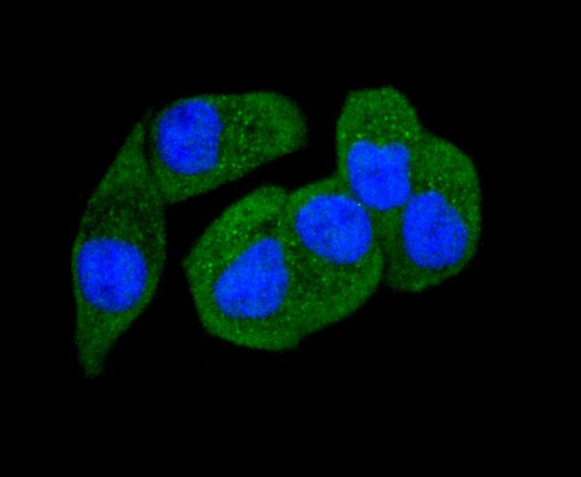 Phospho-PAK1/2/3 (Ser144, Ser141, Ser139) Antibody in Immunocytochemistry (ICC/IF)