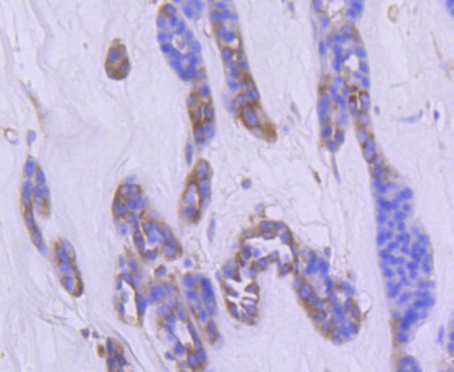 Phospho-PAK1/2/3 (Ser144, Ser141, Ser139) Antibody in Immunohistochemistry (Paraffin) (IHC (P))