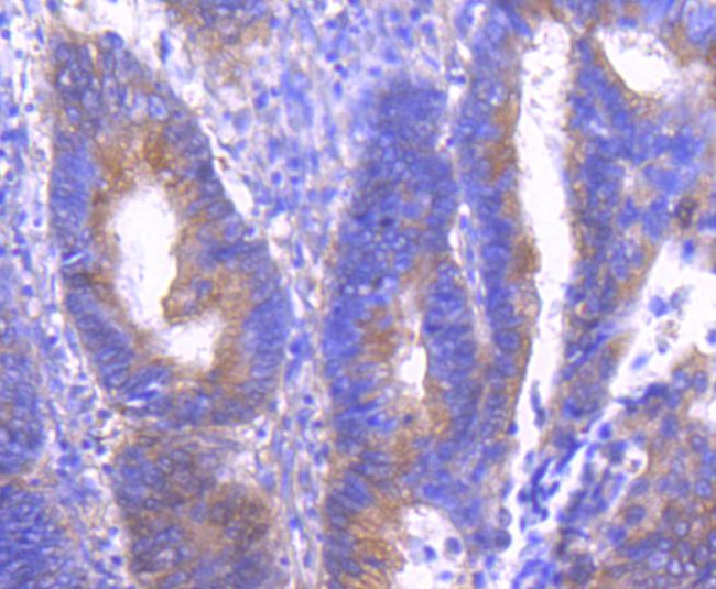 Phospho-PAK1/2/3 (Ser144, Ser141, Ser139) Antibody in Immunohistochemistry (Paraffin) (IHC (P))