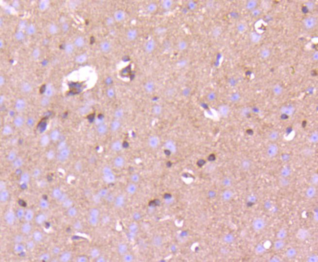 Phospho-PAK1/2/3 (Ser144, Ser141, Ser139) Antibody in Immunohistochemistry (Paraffin) (IHC (P))