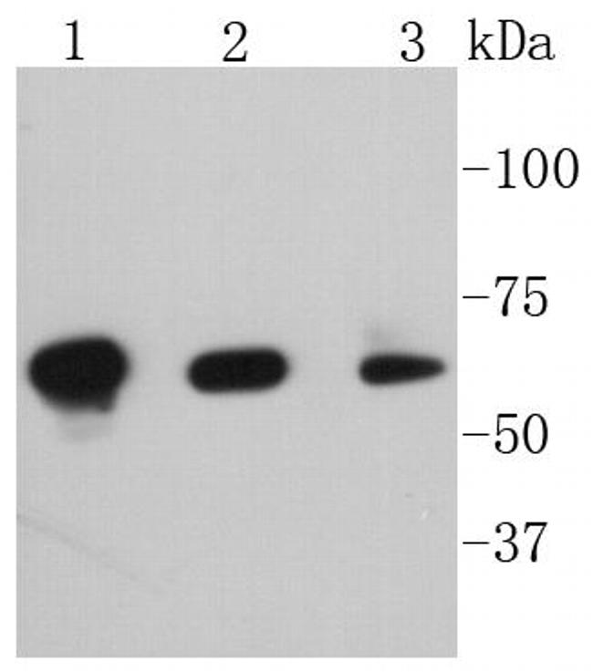 Phospho-PAK1/2/3 (Ser144, Ser141, Ser139) Antibody in Western Blot (WB)