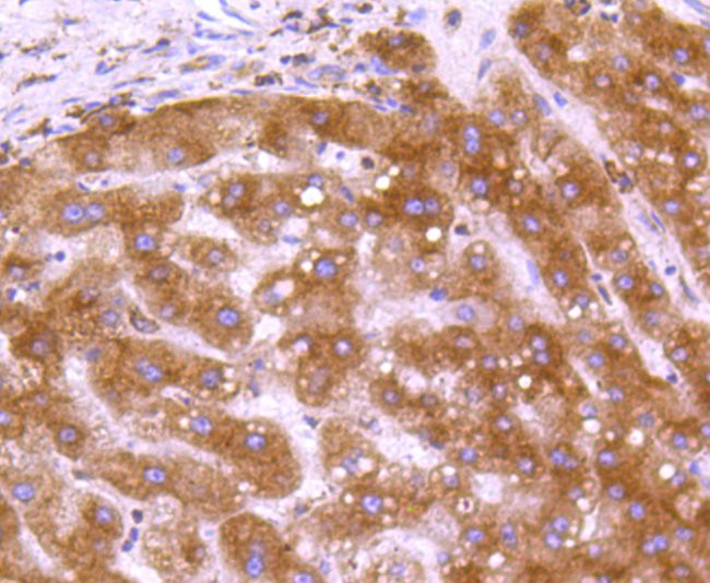 Calreticulin Antibody in Immunohistochemistry (Paraffin) (IHC (P))