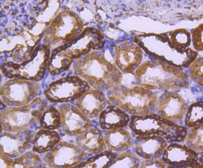 Calreticulin Antibody in Immunohistochemistry (Paraffin) (IHC (P))