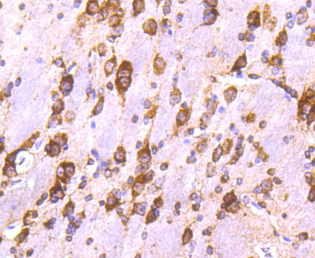 Calreticulin Antibody in Immunohistochemistry (Paraffin) (IHC (P))