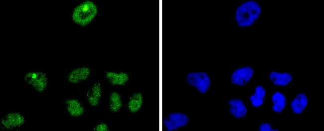 p27 Kip1 Antibody in Immunocytochemistry (ICC/IF)