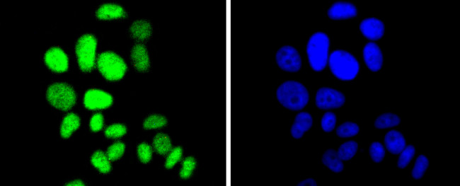 p27 Kip1 Antibody in Immunocytochemistry (ICC/IF)