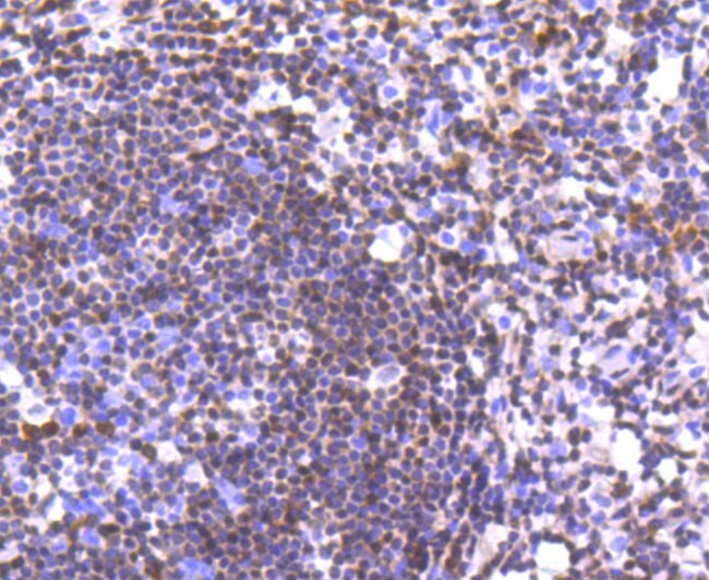 p27 Kip1 Antibody in Immunohistochemistry (Paraffin) (IHC (P))