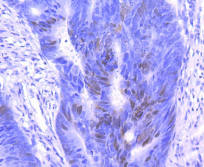 p27 Kip1 Antibody in Immunohistochemistry (Paraffin) (IHC (P))