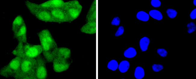 p16INK4a Antibody in Immunocytochemistry (ICC/IF)