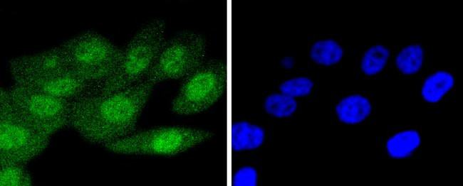 p16INK4a Antibody in Immunocytochemistry (ICC/IF)