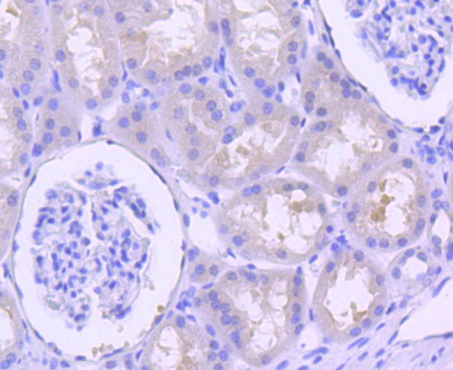 p16INK4a Antibody in Immunohistochemistry (Paraffin) (IHC (P))