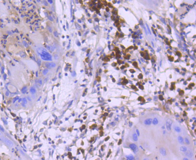 Active/Pro-Caspase 3 Antibody in Immunohistochemistry (Paraffin) (IHC (P))