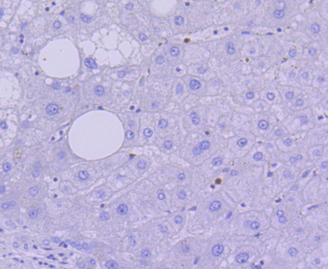 Active/Pro-Caspase 3 Antibody in Immunohistochemistry (Paraffin) (IHC (P))