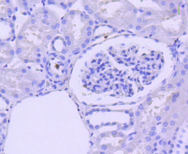 Active/Pro-Caspase 3 Antibody in Immunohistochemistry (Paraffin) (IHC (P))