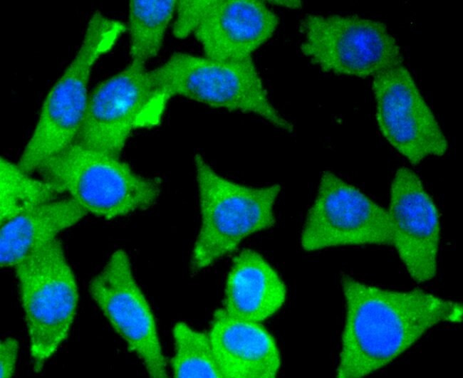 MYLK Antibody in Immunocytochemistry (ICC/IF)