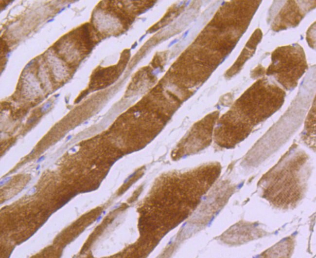 MYLK Antibody in Immunohistochemistry (Paraffin) (IHC (P))