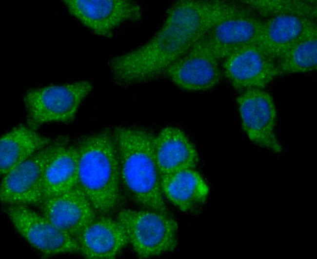 M-CSF Antibody in Immunocytochemistry (ICC/IF)