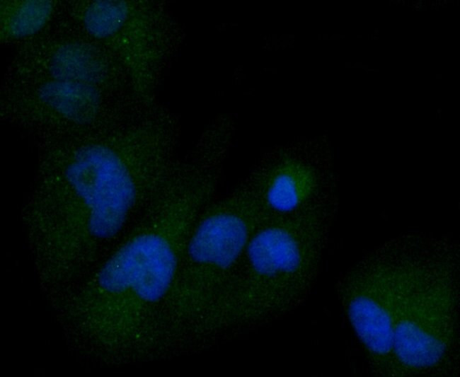 M-CSF Antibody in Immunocytochemistry (ICC/IF)