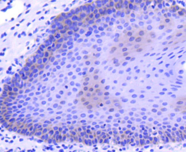 M-CSF Antibody in Immunohistochemistry (Paraffin) (IHC (P))