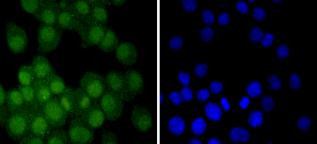 Androgen Receptor Antibody in Immunocytochemistry (ICC/IF)