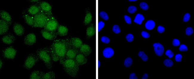 Androgen Receptor Antibody in Immunocytochemistry (ICC/IF)