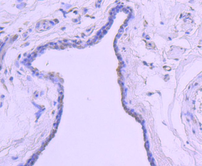 Androgen Receptor Antibody in Immunohistochemistry (Paraffin) (IHC (P))