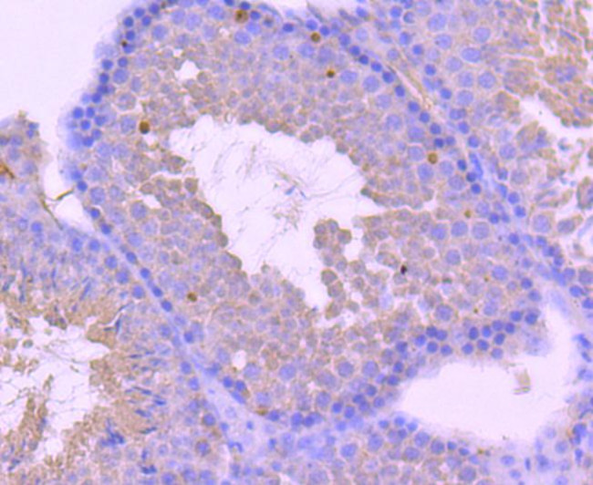 Androgen Receptor Antibody in Immunohistochemistry (Paraffin) (IHC (P))