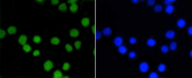 ASH2L Antibody in Immunocytochemistry (ICC/IF)