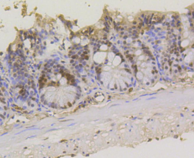 ASH2L Antibody in Immunohistochemistry (Paraffin) (IHC (P))