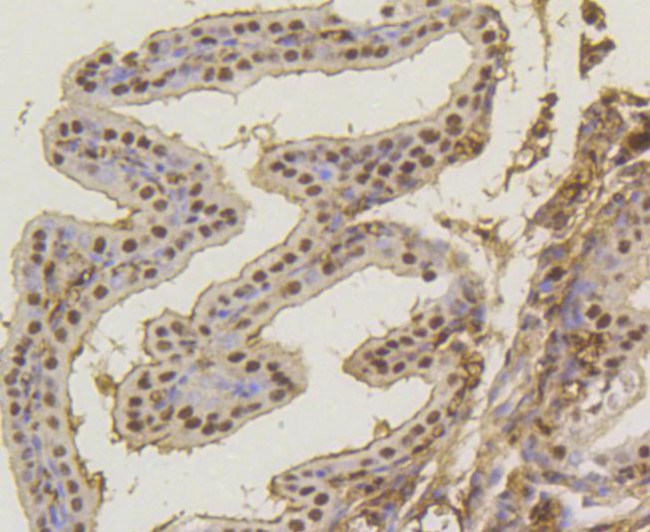 ASH2L Antibody in Immunohistochemistry (Paraffin) (IHC (P))