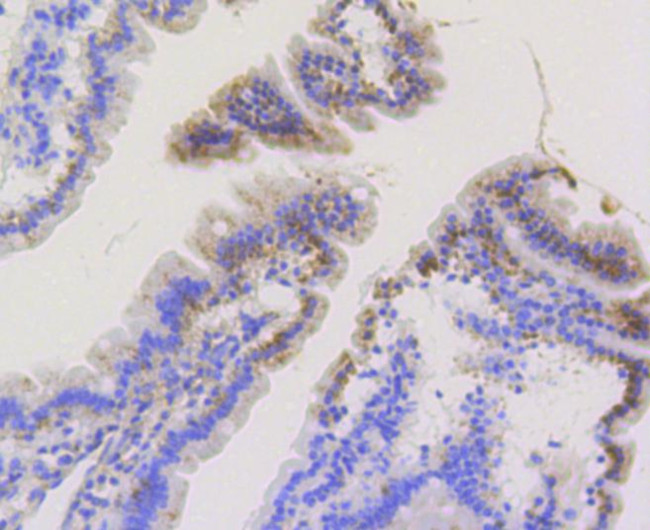 TOMM20 Antibody in Immunohistochemistry (Paraffin) (IHC (P))