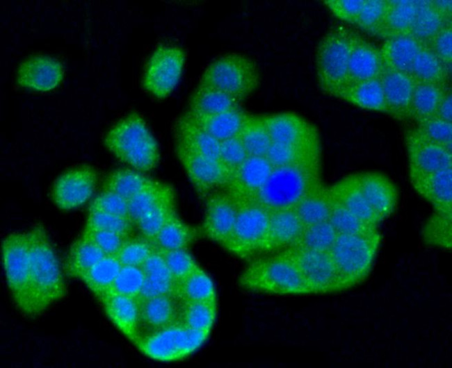 LC3A Antibody in Immunocytochemistry (ICC/IF)