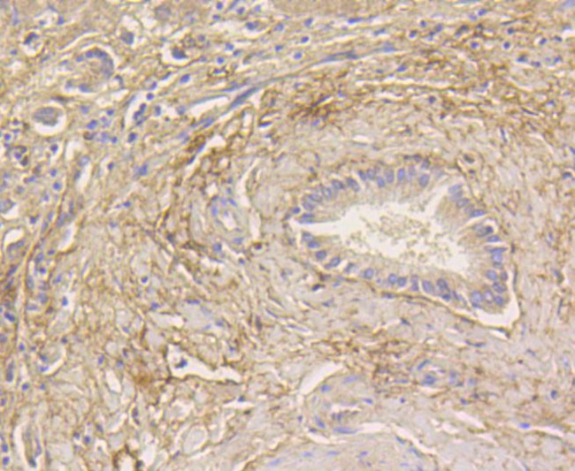 LC3A Antibody in Immunohistochemistry (Paraffin) (IHC (P))