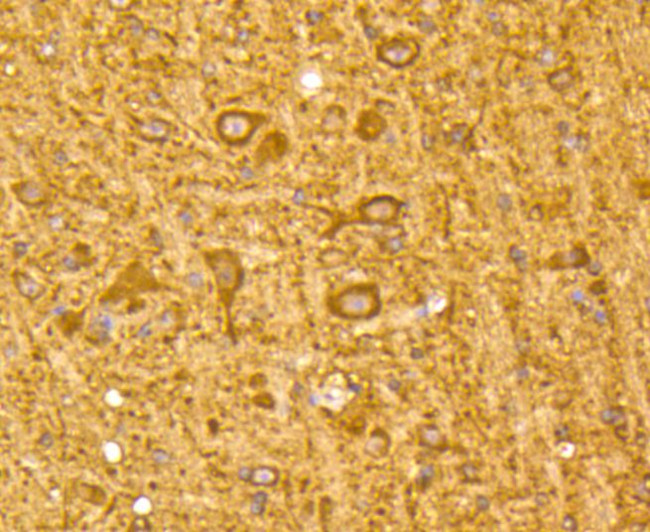 LC3A Antibody in Immunohistochemistry (Paraffin) (IHC (P))