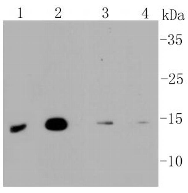 LC3A Antibody in Western Blot (WB)