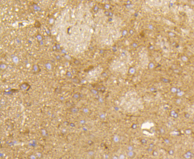 RAB5 Antibody in Immunohistochemistry (Paraffin) (IHC (P))