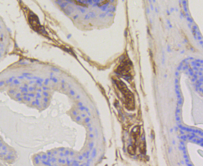 RAB5 Antibody in Immunohistochemistry (Paraffin) (IHC (P))