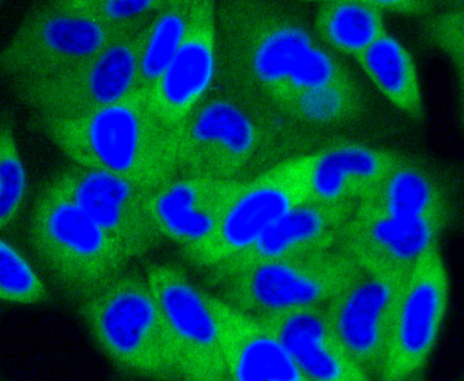 PIK3R2 Antibody in Immunocytochemistry (ICC/IF)