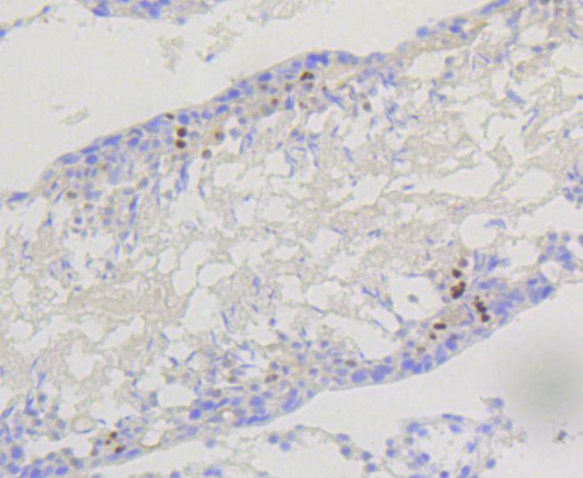 PIK3R2 Antibody in Immunohistochemistry (Paraffin) (IHC (P))