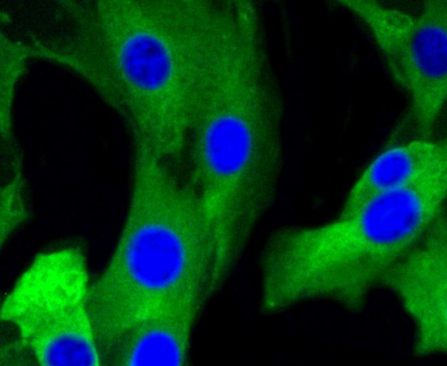 mGluR5 Antibody in Immunocytochemistry (ICC/IF)